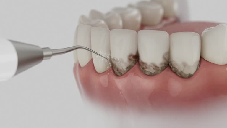 Trusted Invisalign Clear Aligners service in Roanoke Rapids, NC - Dentist Open Now